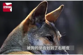 狗咬破皮，就能致狂犬病？ #硬核健康科普行动  
#狂犬病