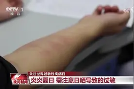 科普丨皮肤红肿、瘙痒？你可能“对太阳过敏”！防护指南快查收图片