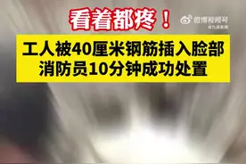 【#工人被40厘米钢筋插入脸部#，消防10分钟成功处置】图片