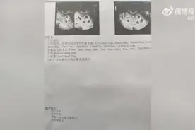 怀9胞胎女子将减去7个胚胎，丈夫：怀胎太多致妻子体虚图片