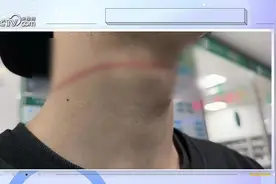 风筝线变伤人“利器” 谁来管谁能管？图片