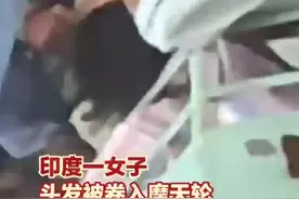 女子头发被卷入摩天轮，头发被全部剪断才得以脱身图片