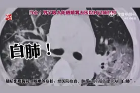 【停止错误操作！#男子吸入防晒喷雾就医时已变白肺#】图片