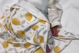 新生女婴骨折16小时后腿部溃烂图片