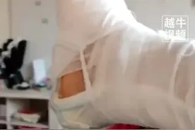 女儿回家看到爸爸受伤，得知少了一根脚趾后瞬间变脸，忍不住在妈妈怀里哭起来图片