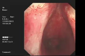 完美解决声门下气管狭窄方案，恢复自然腔道，畅快呼吸视频封面